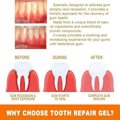 Eelhoe - Gum Repair Essence Ampoules