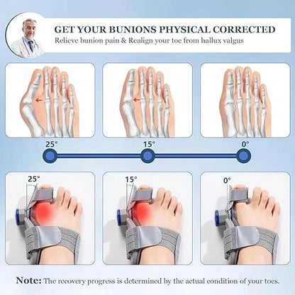 FeetifFix - Bunion Corrector