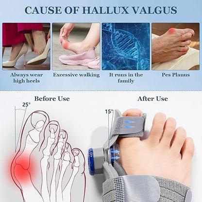 FeetifFix - Bunion Corrector